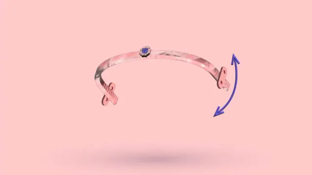 A 3D Nuss bar with curved arrows showing it rotating out of position
