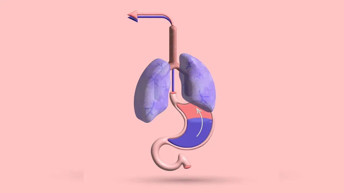 Pectus Excavatum Burping & Hiccups: Diet, Digestion