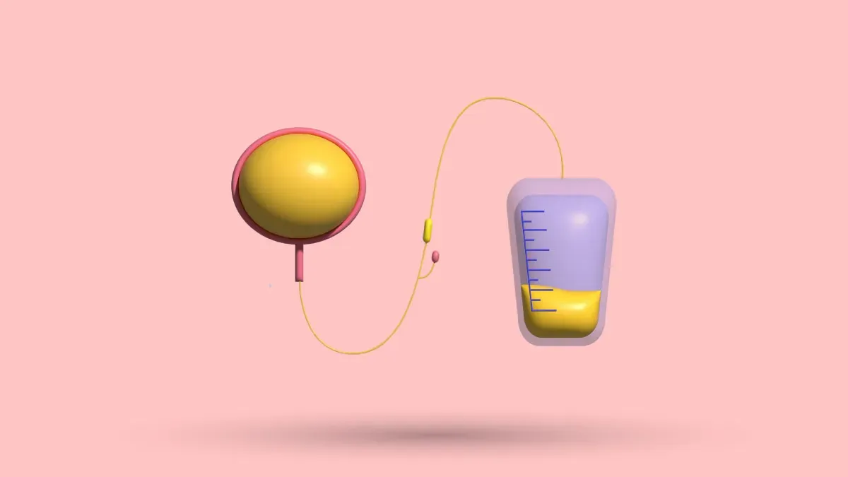 Catheter After Pectus Nuss Procedure: What To Expect & More