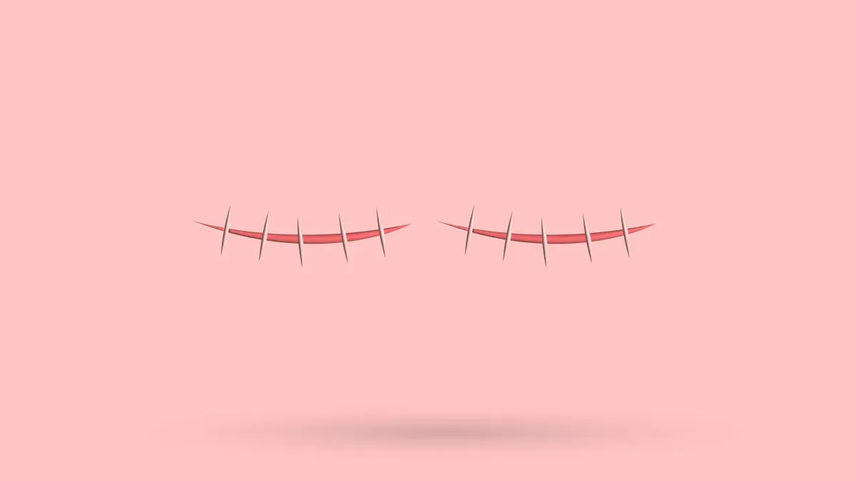 Man Boobs After Pectus Surgery: Hormones, Symptoms + Tips