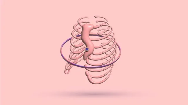 A 3D rib cage with a ring encircling it at the level of the lower ribs