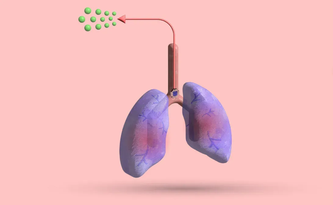 Pectus Excavatum Post-Op Sneezing Pain: Cause & More