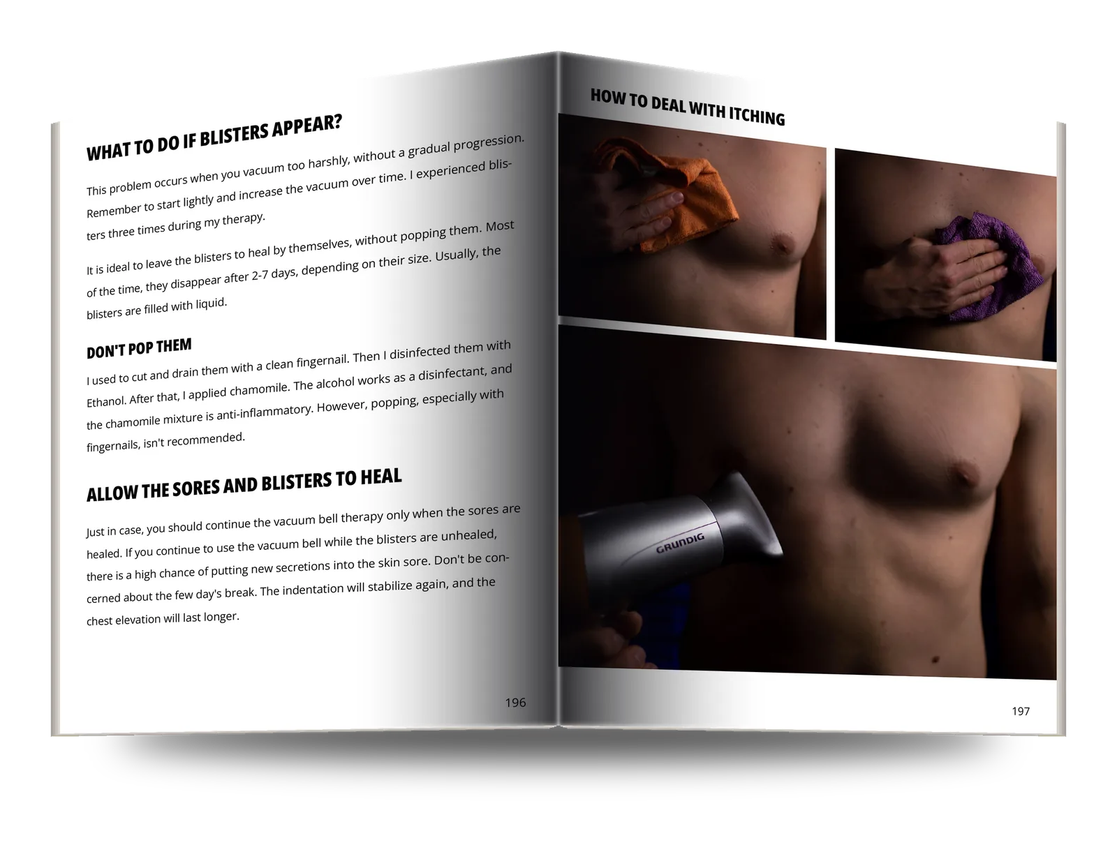A spread showing photographed steps for treating skin irritation from the vacuum bell