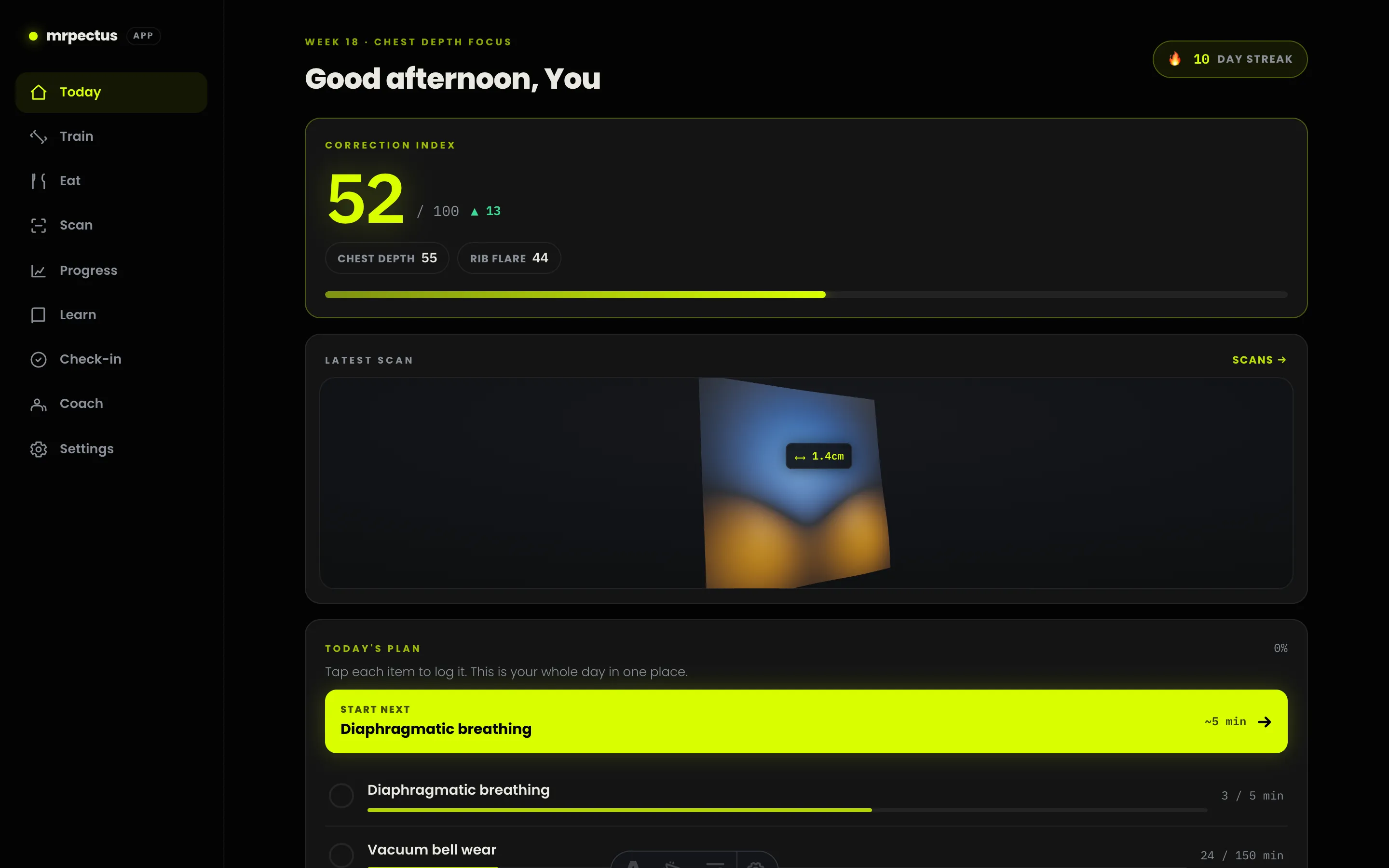 The Today screen of the mrpectus app