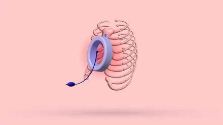 Pain While Applying Vacuum Bell: How To Prevent & More