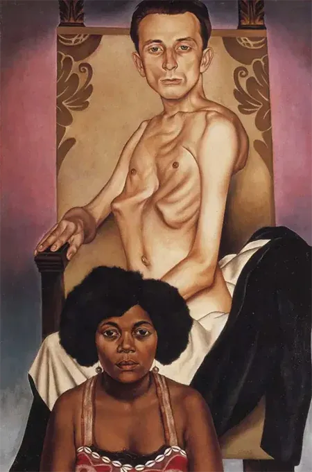 Agosta the pigeon chested man and rasha the black dove chest deformity