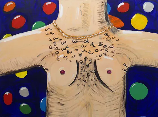 Elad rosen pectus excavatum