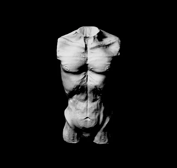 Victor malloni pectus excavatum