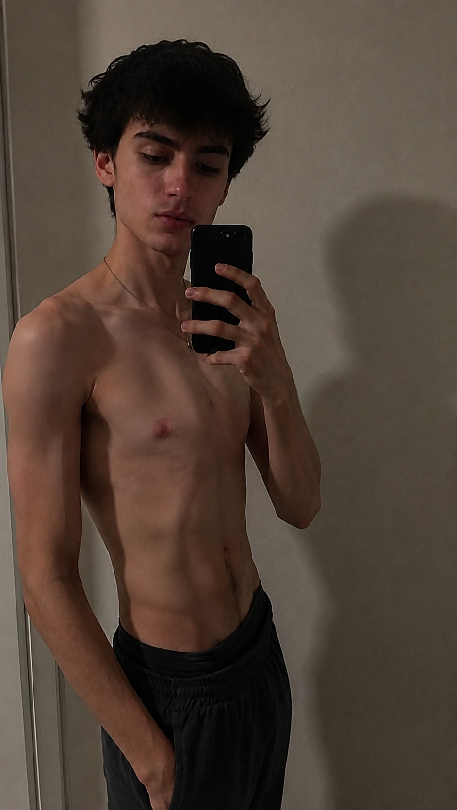 Ethan — pectus carinatum chest before and after 3 months of exercise and 1-on-1 coaching